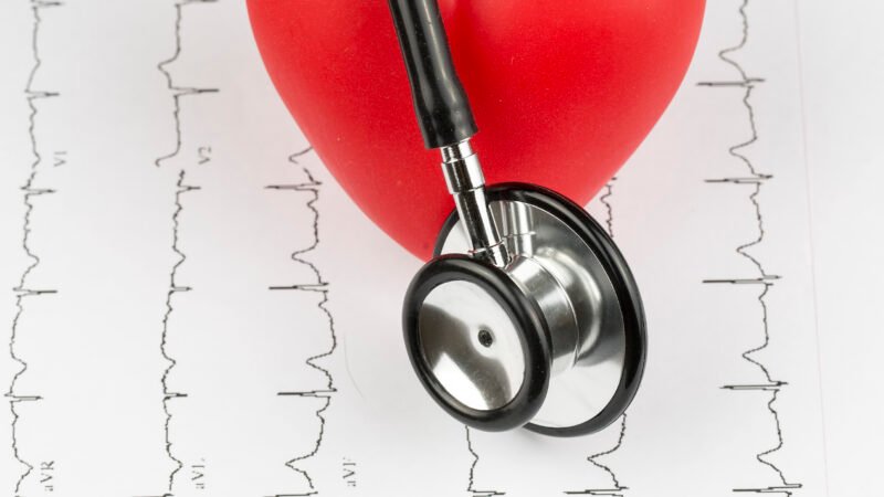 Cardiologia ambulatorial: descarte de ECG, Holter, teste ergométrico e ecocardiograma