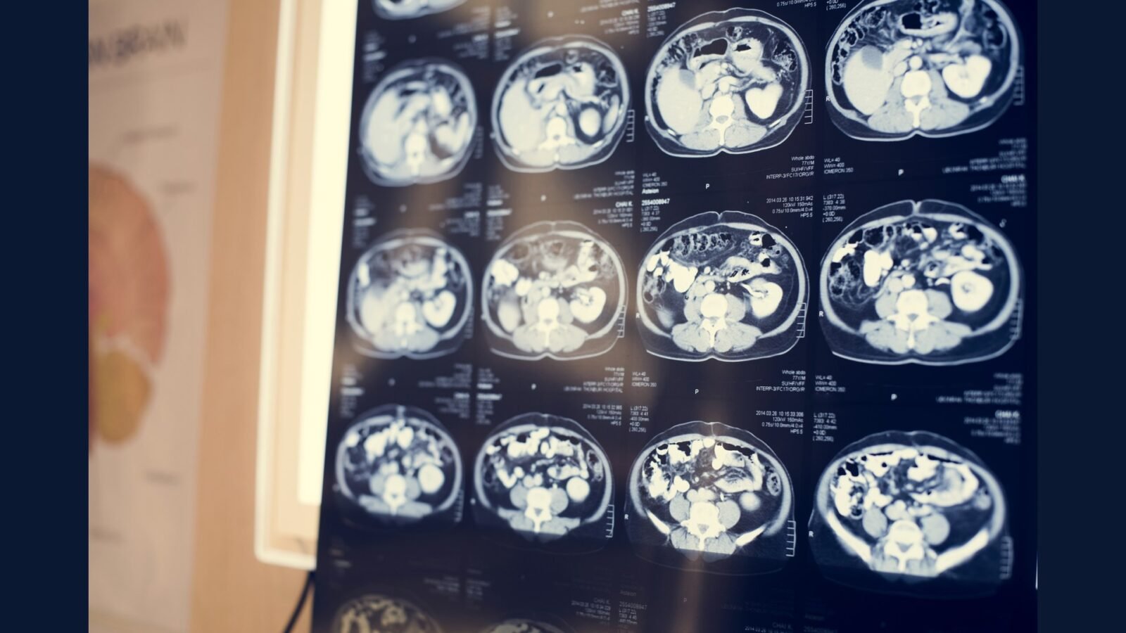 Centro de medicina nuclear ambulatorial: PGRSS
