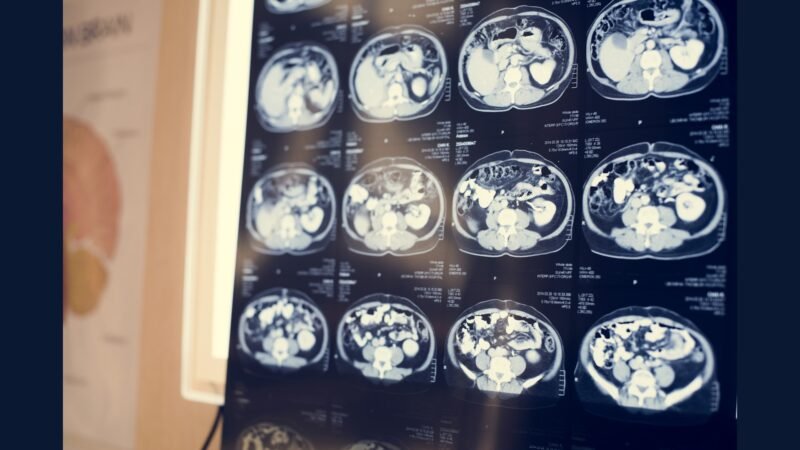 Centro de medicina nuclear ambulatorial: PGRSS