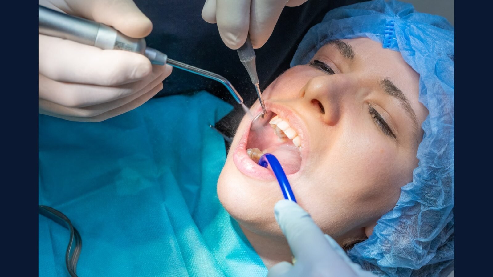 Coleta de RSS em Cirurgia Bucomaxilofacial