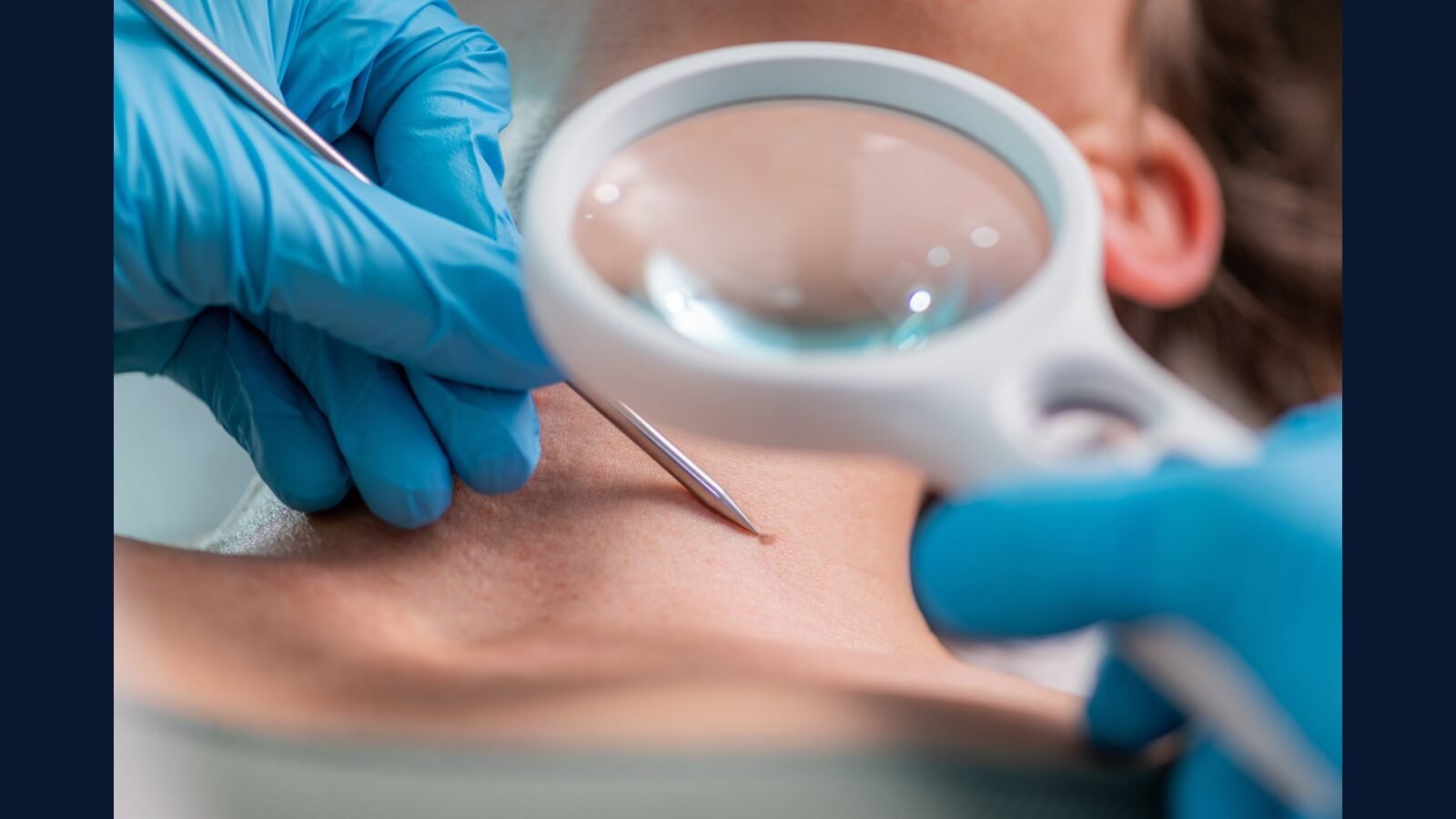 Coleta de RSS em Clínica de Dermatologia