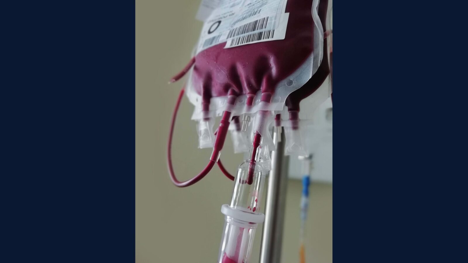 Como Descartar Bolsa de Sangue Vencida?