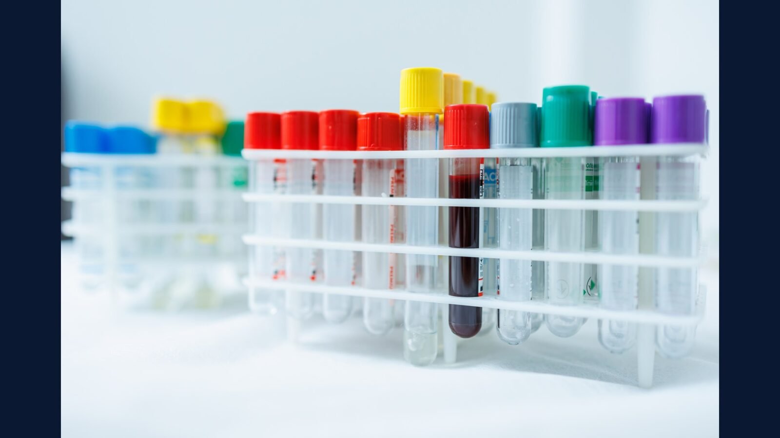 Como Descartar Material de Endoscopia?