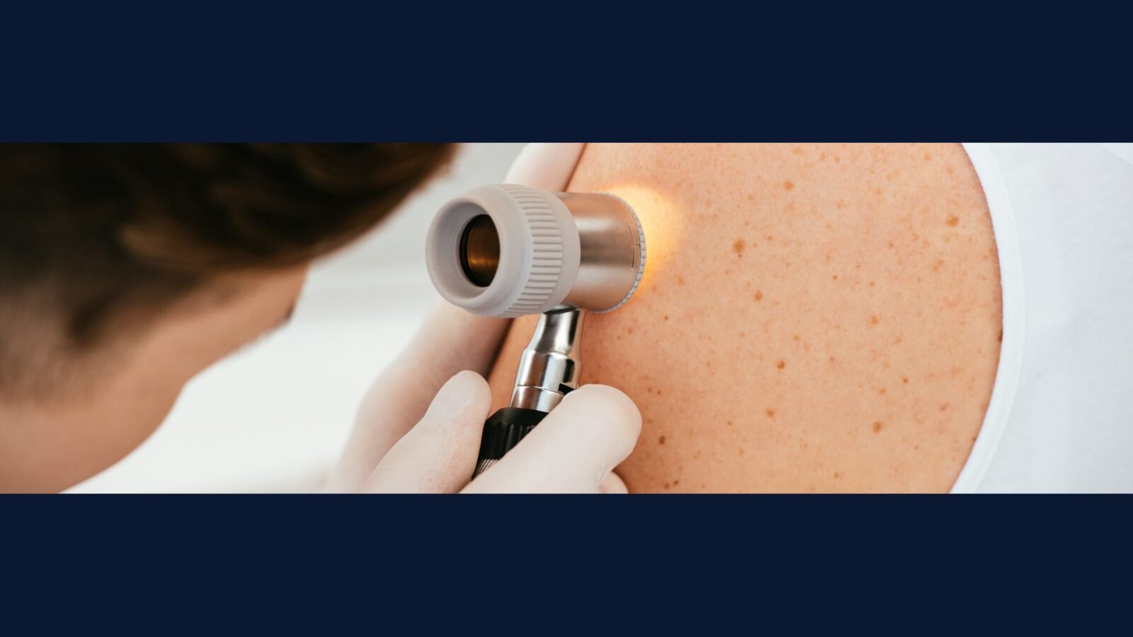 Como Descartar Resíduo de Criocirurgia