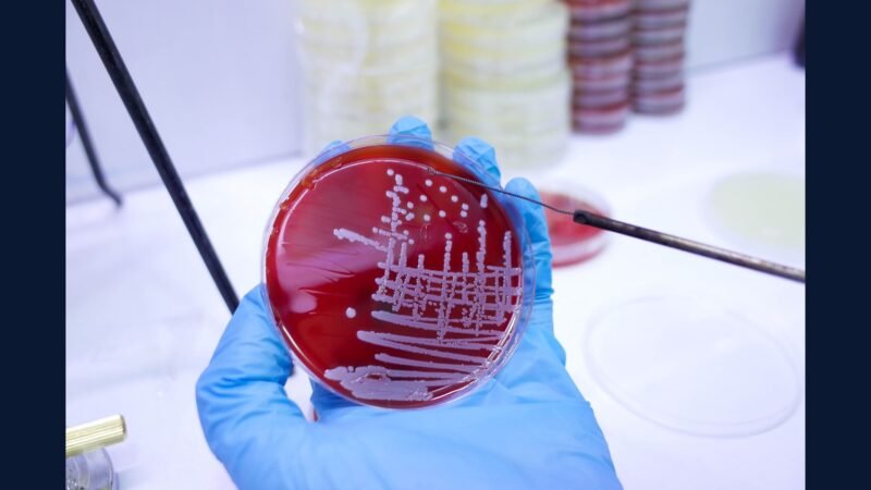 Como Descartar Resíduo de Cultura Microbiológica