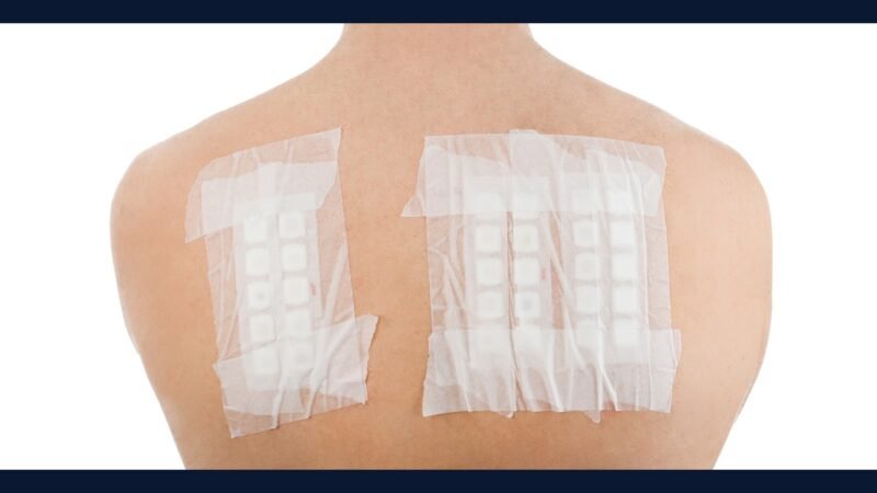 Como Descartar Resíduo de Teste de Contato (Patch Test)