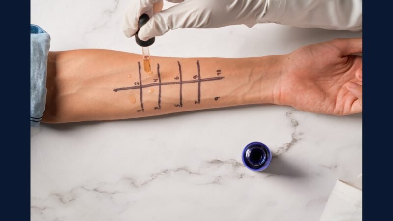 Como Descartar Resíduo de Teste Alérgico (Prick Test)