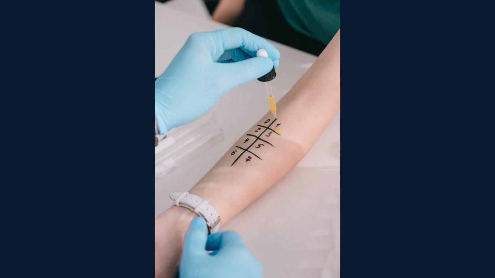 Como Descartar Resíduo de Teste Tuberculínico (PPD)