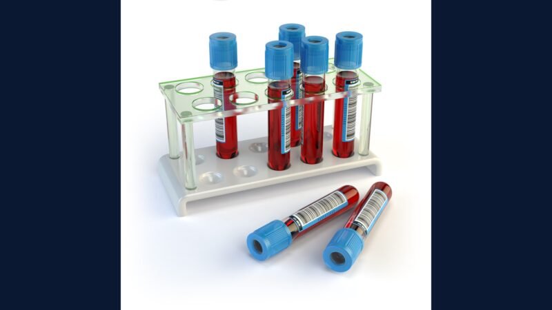 Como Descartar Tubos de Coleta de Sangue