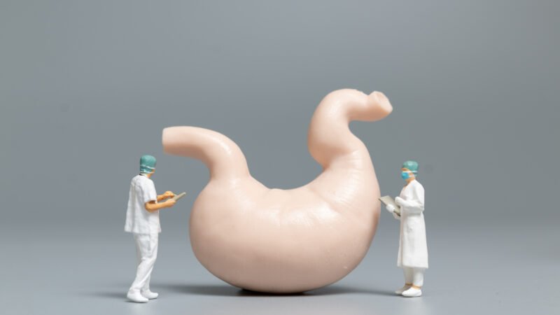 Gastroenterologia: descarte em endoscopia ambulatorial e CPRE — RSS de alto volume