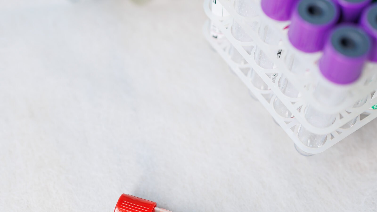 Hematologia: descarte de coleta especializada, mielograma e biópsia de medula