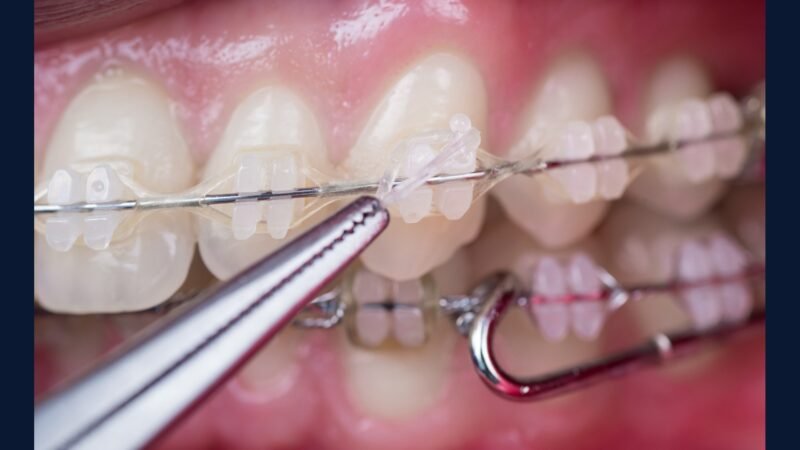 Odontogeriatria e pacientes especiais: PGRSS