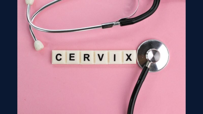 PGRSS cervical: CCC, Wertheim, brachy, Pap