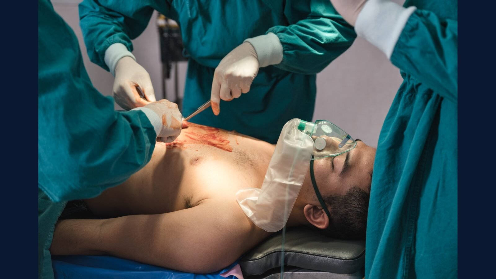 PGRSS cirurgia tórax — VATS RATS e transplante
