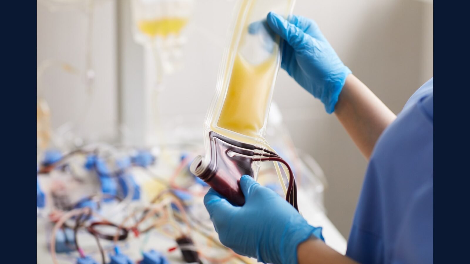 PGRSS aférese terapêutica — LDL, plasma e Ig