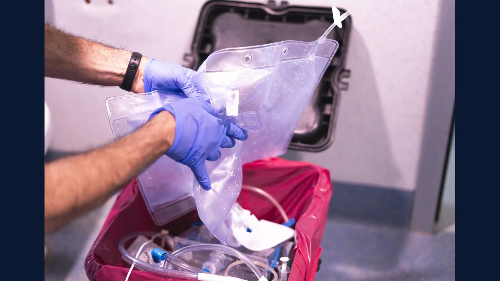 PGRSS clínica nefrologia — CAPD + transplante