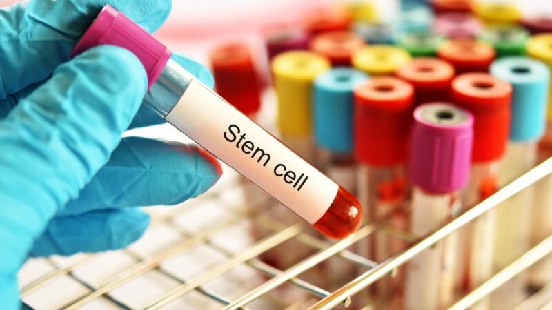 PGRSS clínica de ortobiologia — PRP BMAC e exossomos