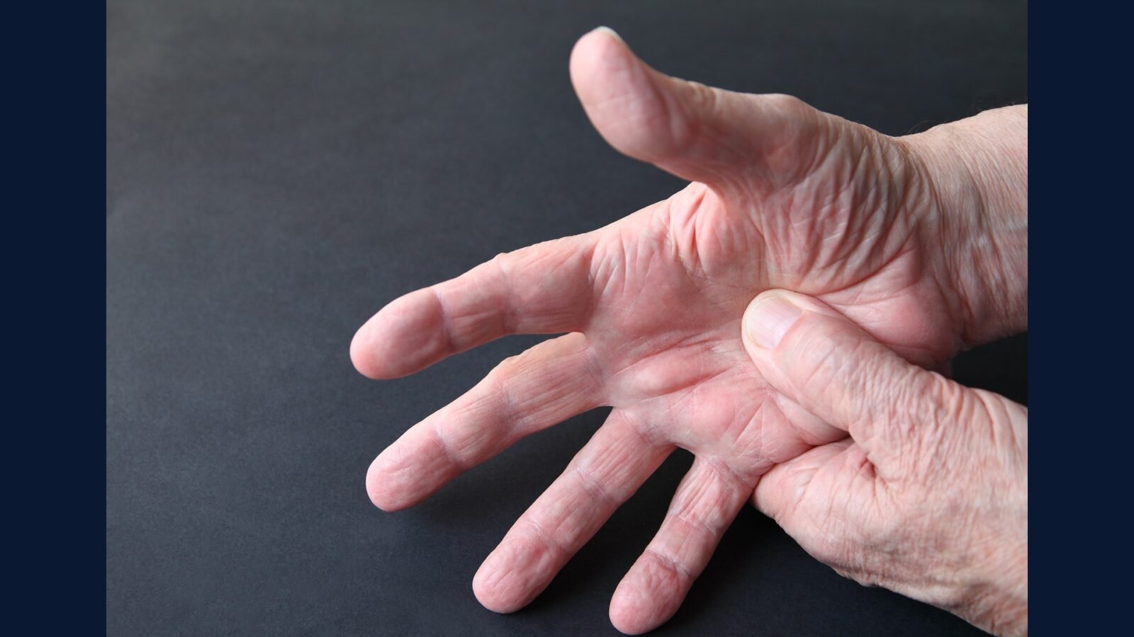 PGRSS reumatologia — biológico imunossupressor e infusão