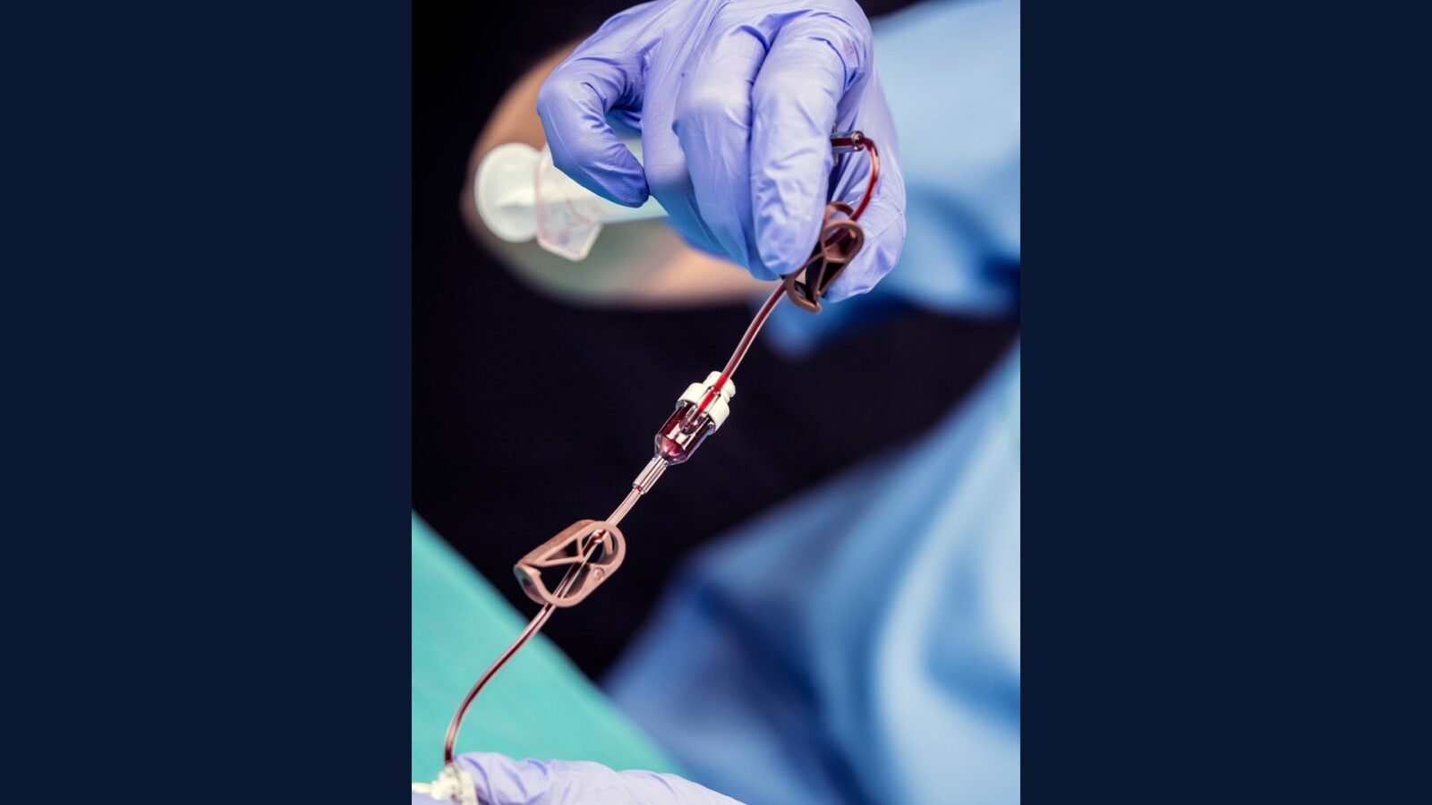 PGRSS clínica vascular — angioplastia EVAR e ablação