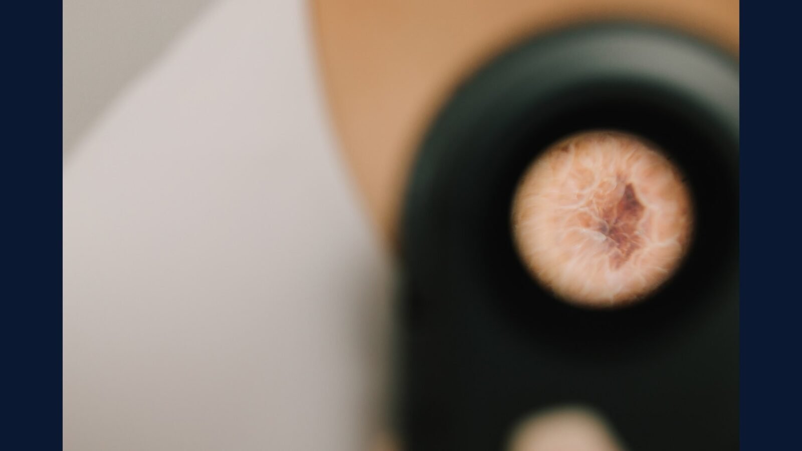 PGRSS dermatologia oncológica — Mohs e melanoma