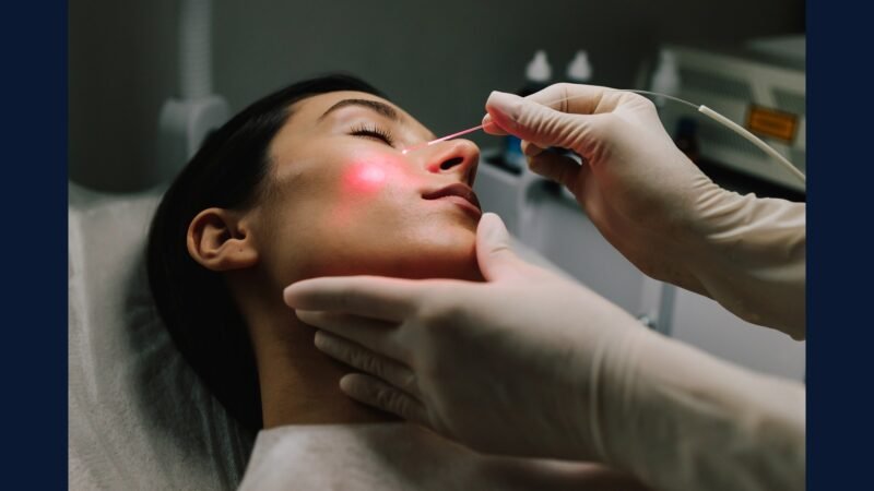 PGRSS estética avançada — ultraformer e harmonização