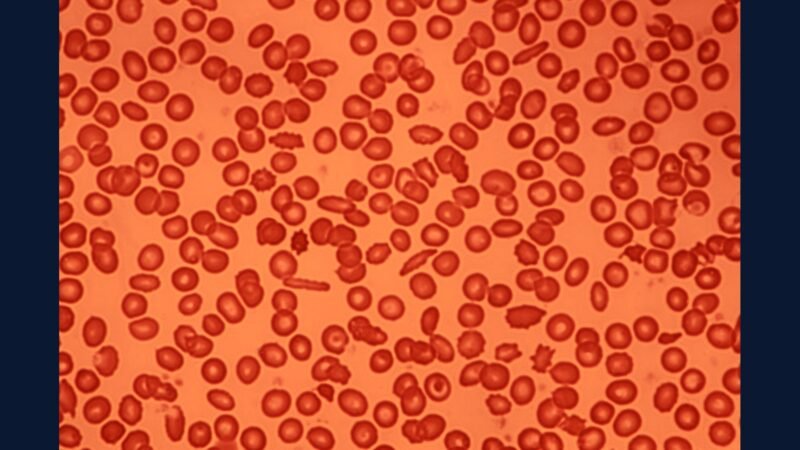 PGRSS hematologia avançada — leucemia TMO e CAR-T