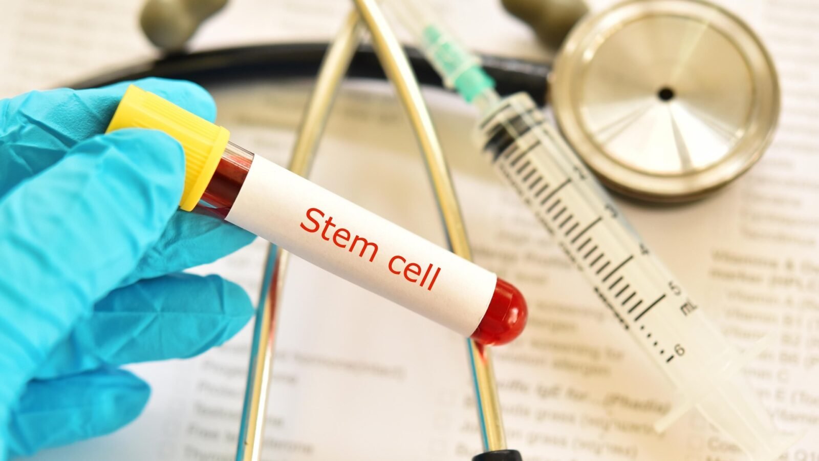 PGRSS hematologia: TMO alogênico, autólogo, haplo, cordão