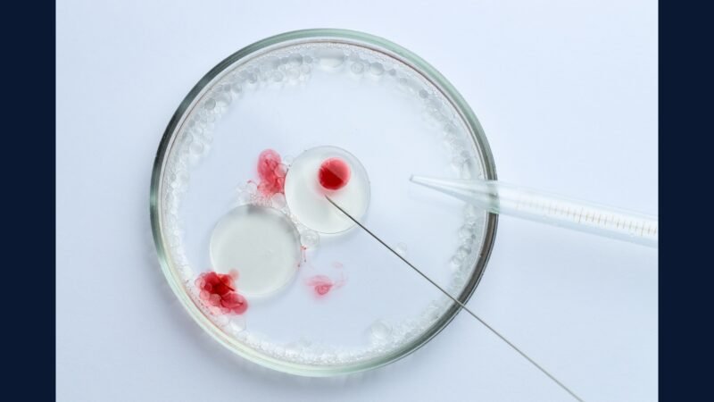 PGRSS infectologia — HIV HCV e resistência microbiana