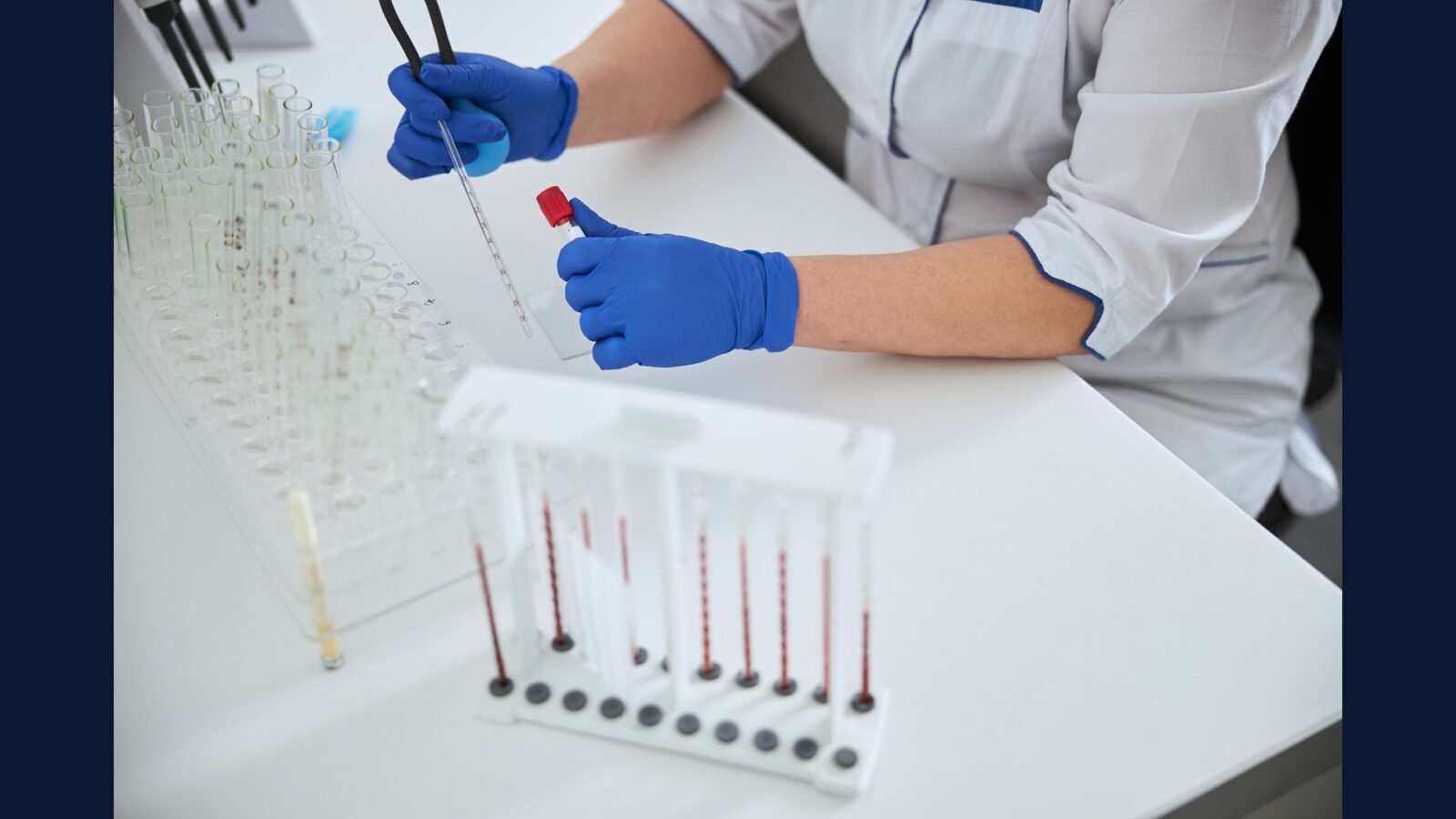 PGRSS para laboratório clínico — bioquímica e microbiologia