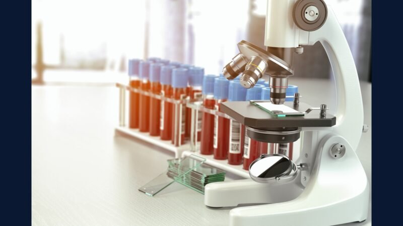 Leucemia: PGRSS Venetoclax VIALE-A CAR-T BCMA Cilta