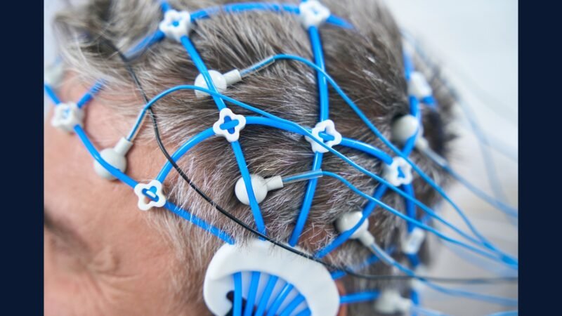 PGRSS para neurologia funcional — EEG e EMG