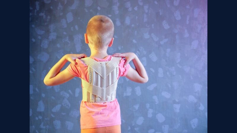 PGRSS ortop pediátrica: escoliose, pectus, pé torto