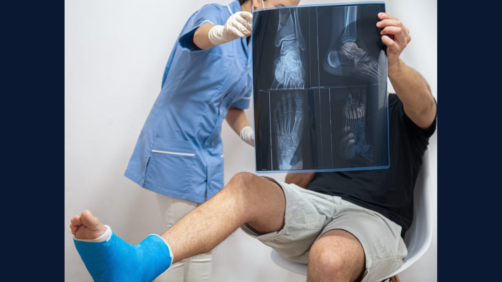 PGRSS ortop trauma: politrauma, fixação, osteossin