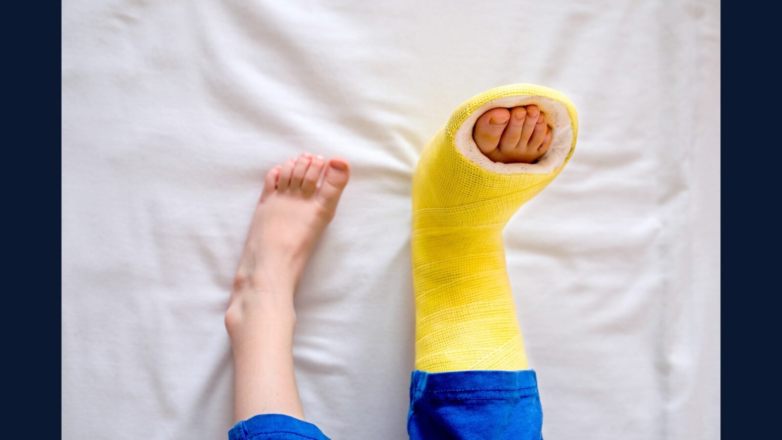PGRSS ortopedia trauma — fixador e politrauma