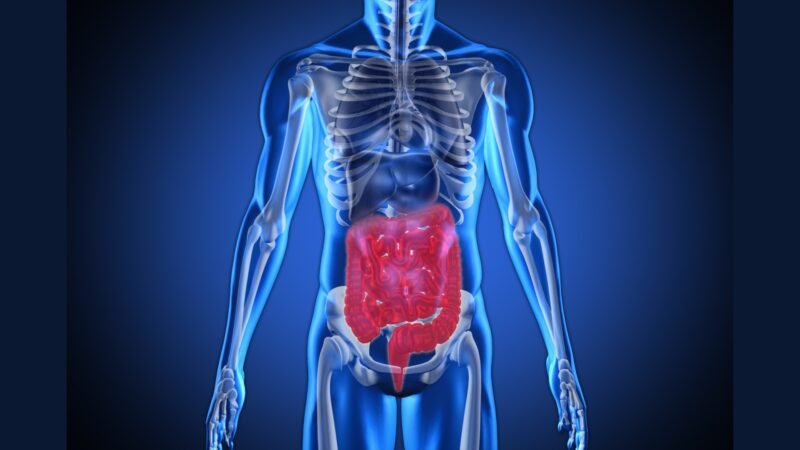 Pancreas: PGRSS FOLFIRINOX NAPOLI-3 Olaparib Whipple