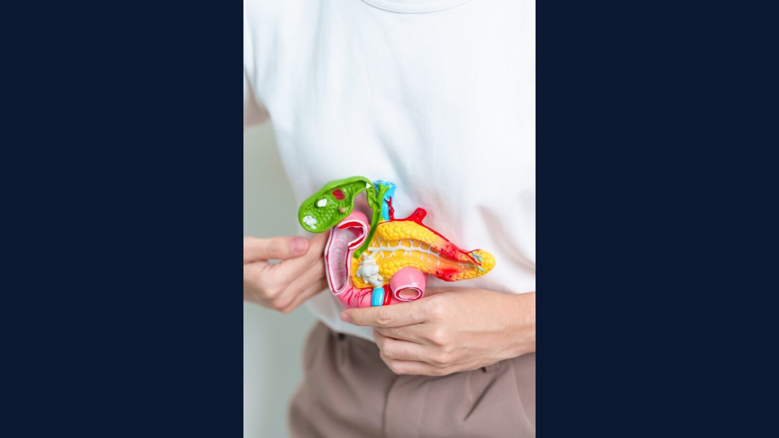 PGRSS pancreática: Whipple, FOLFIRINOX
