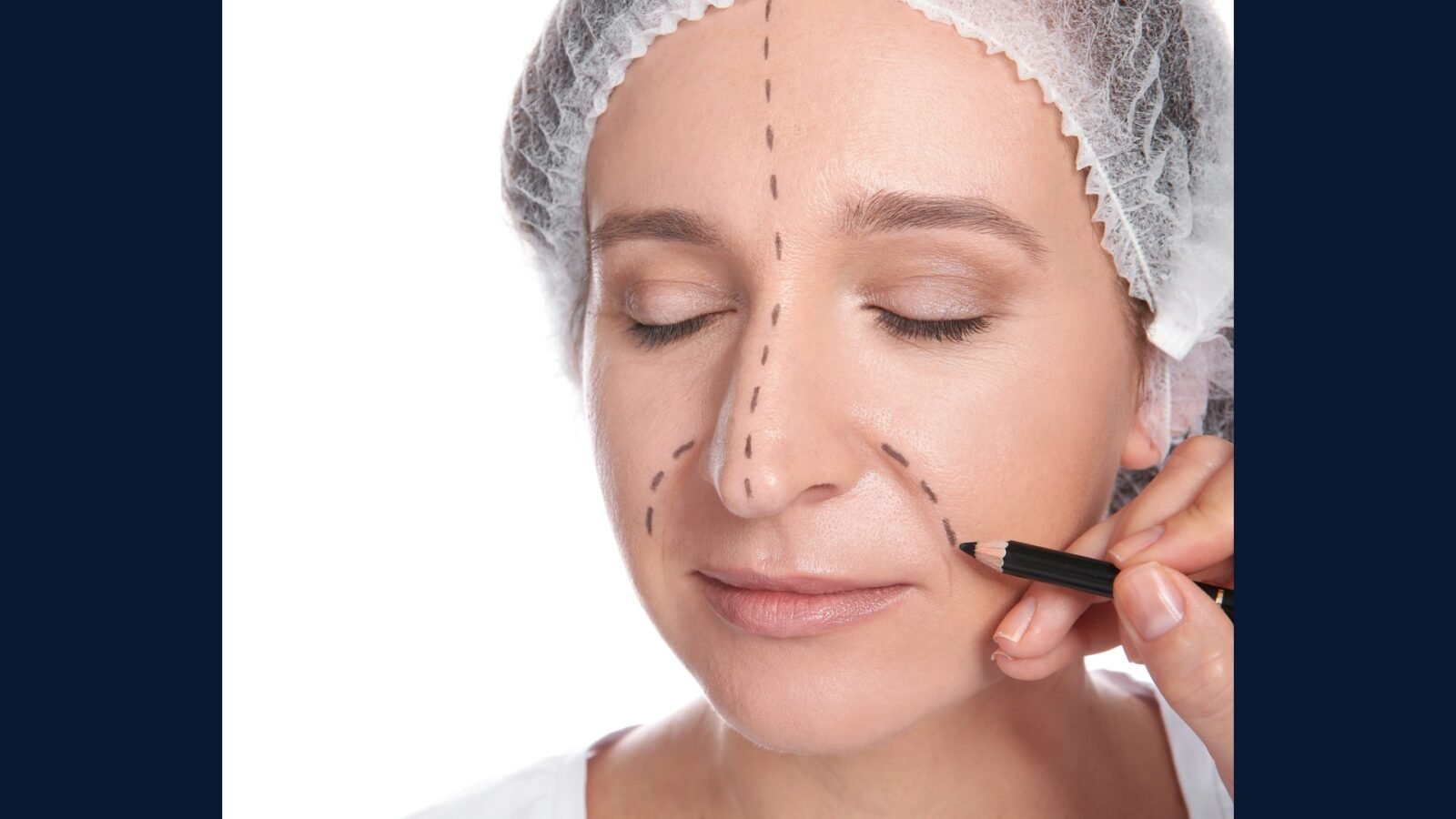 PGRSS plástica facial — lifting e rinoplastia