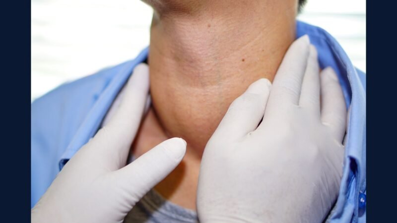 PGRSS tireoide: papilif, medular, anaplas, TT