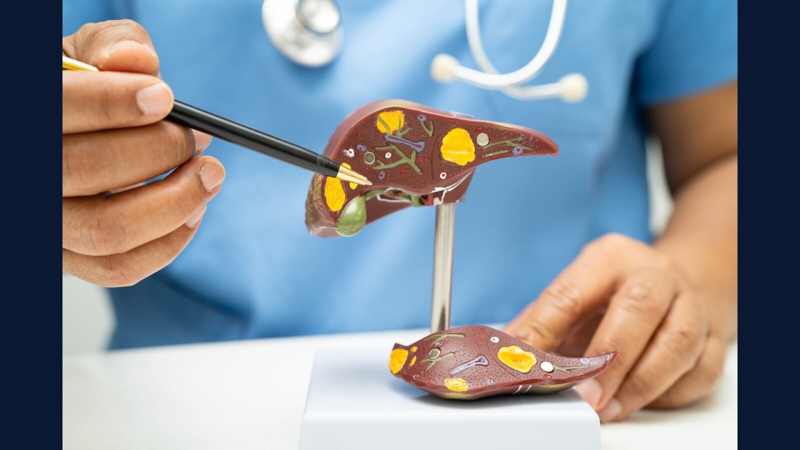 PGRSS transplante hepático: adulto e pediátrico