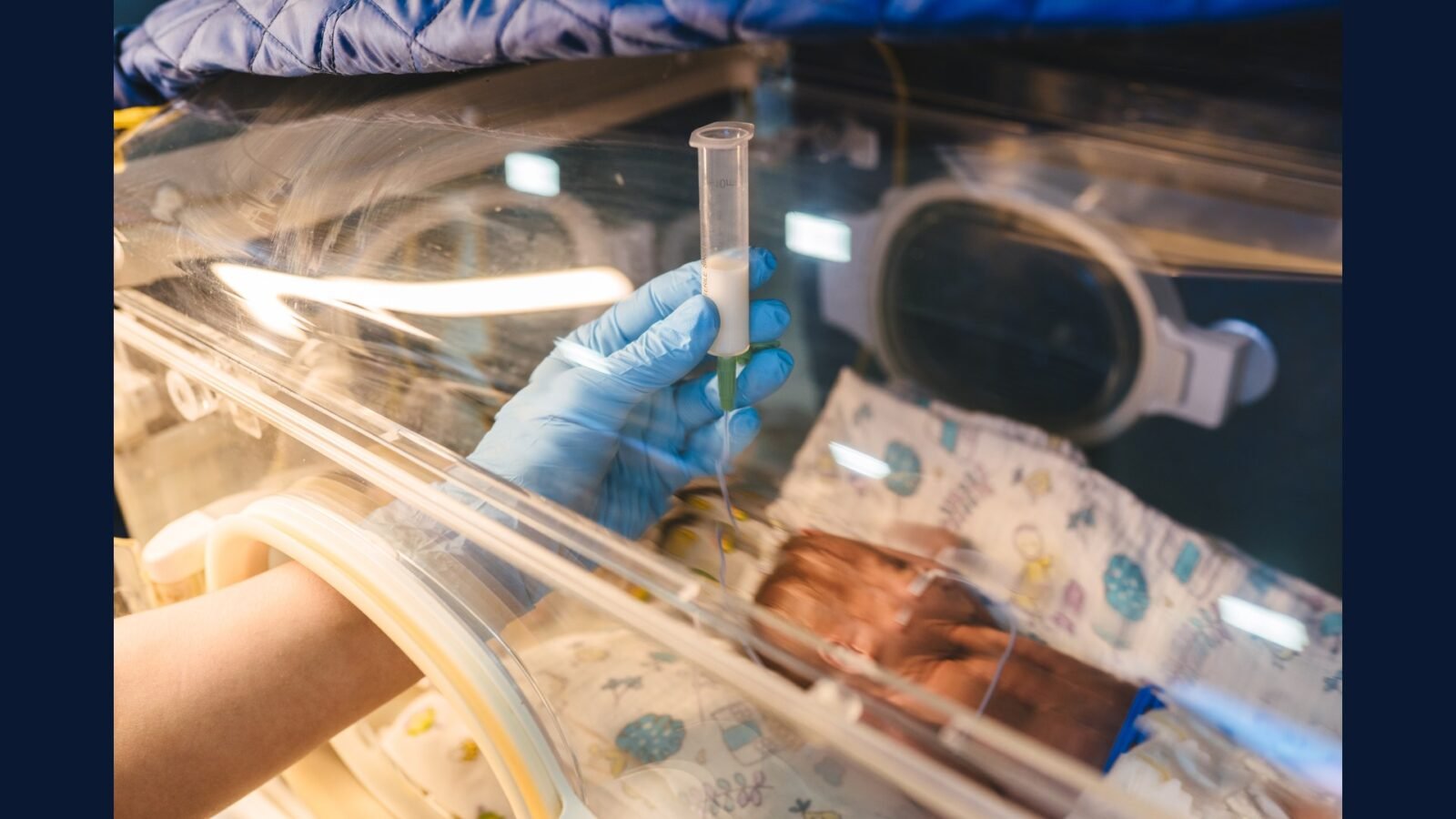 PGRSS UTIN neonatal: surfactante, ECMO, sepse