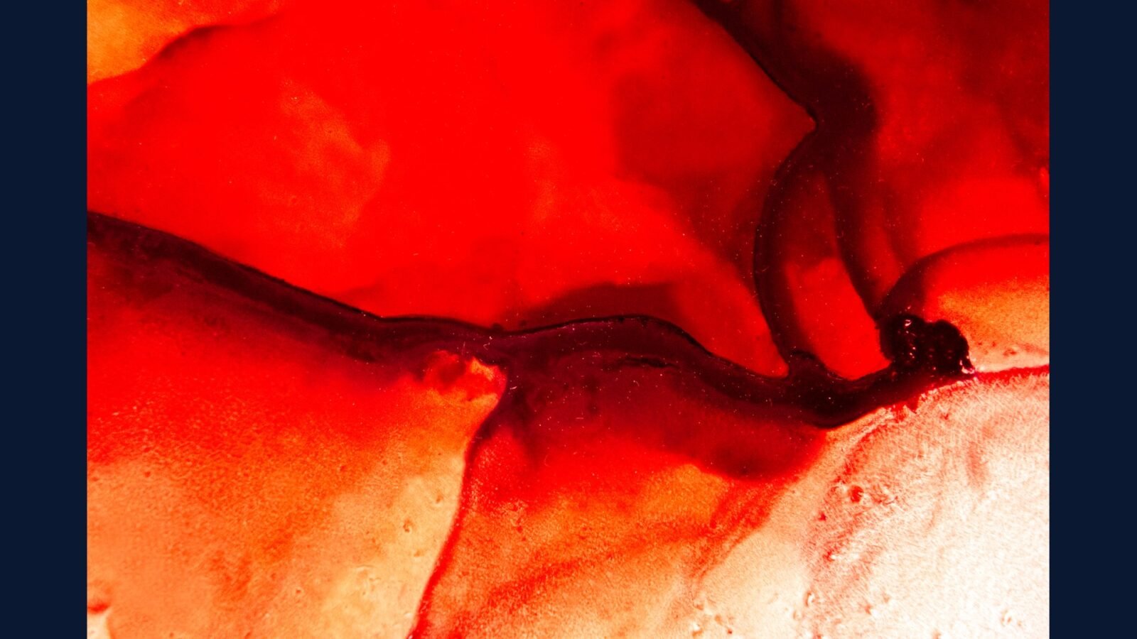 PGRSS vascular: carótida, aneurisma, EVAR, TEVAR