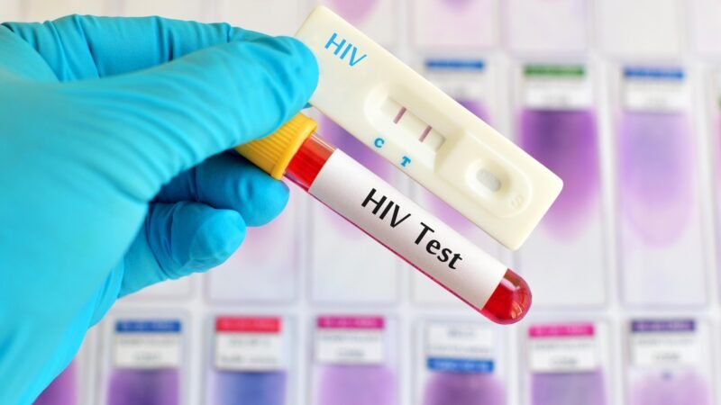 RSS ambulatório DST/IST — HIV, sífilis, HPV