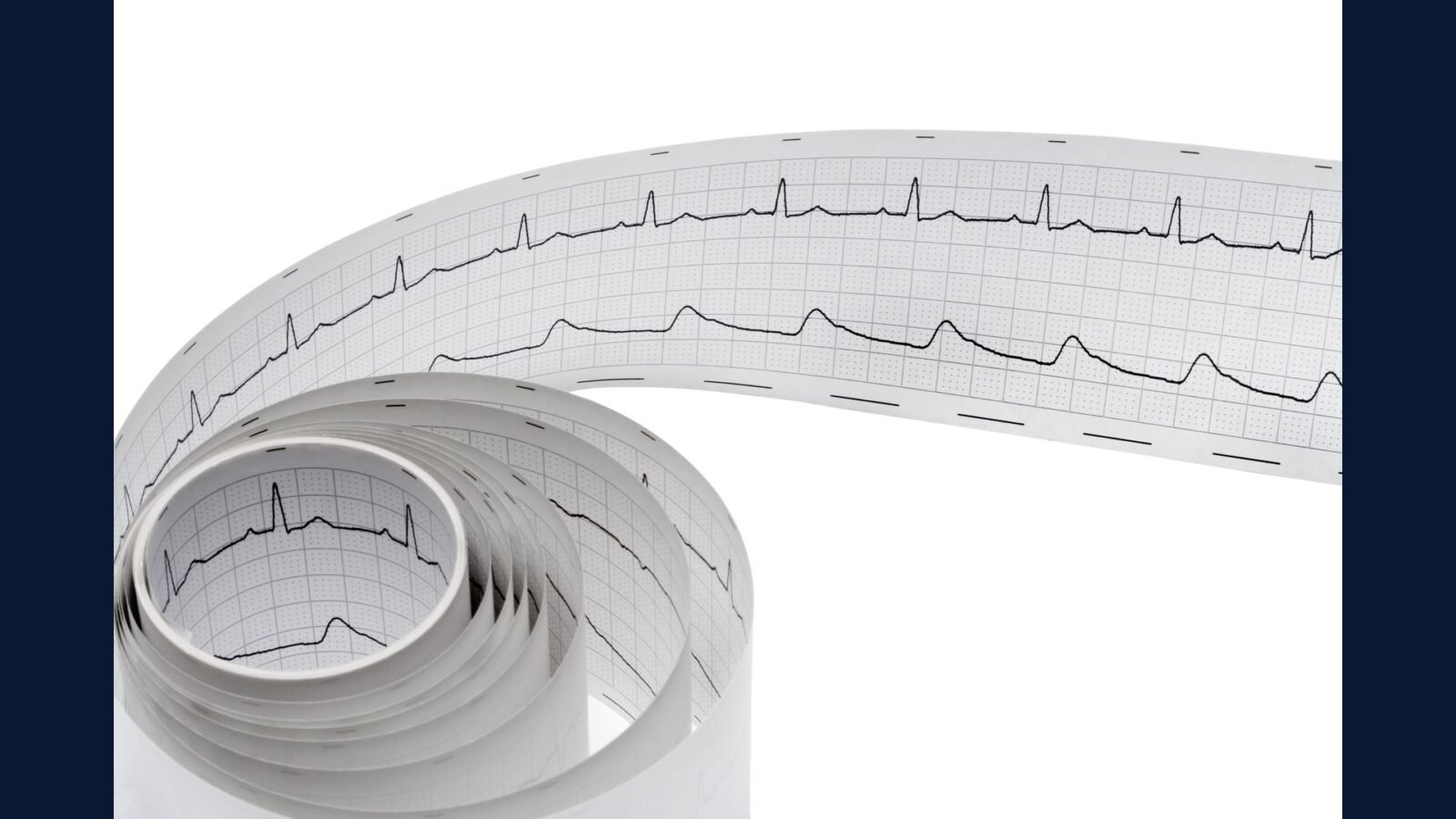 RSS cardio adulto: CRM, AVR, MVR, TAVI