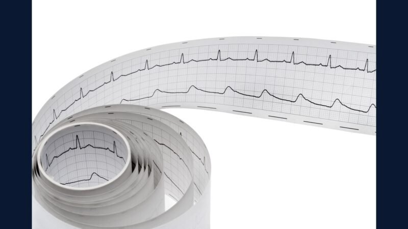 RSS cardio adulto: CRM, AVR, MVR, TAVI