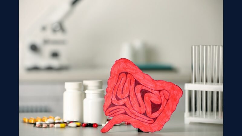 RSS endoscopia avançada — cápsula e enteroscopia