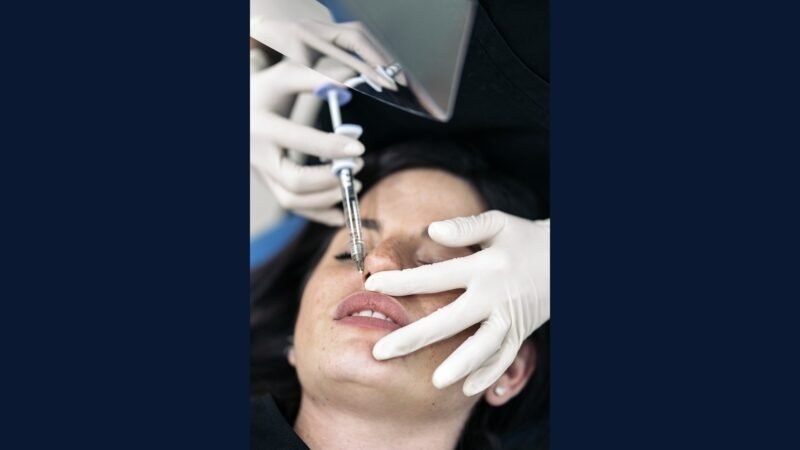 RSS dermato estética: preenchedor, laser CO2