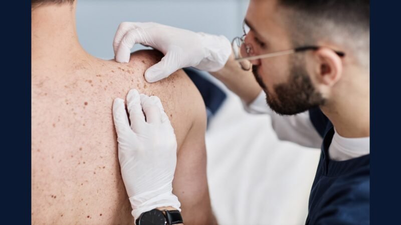 RSS dermato geral: acne, psoríase, UV terapia