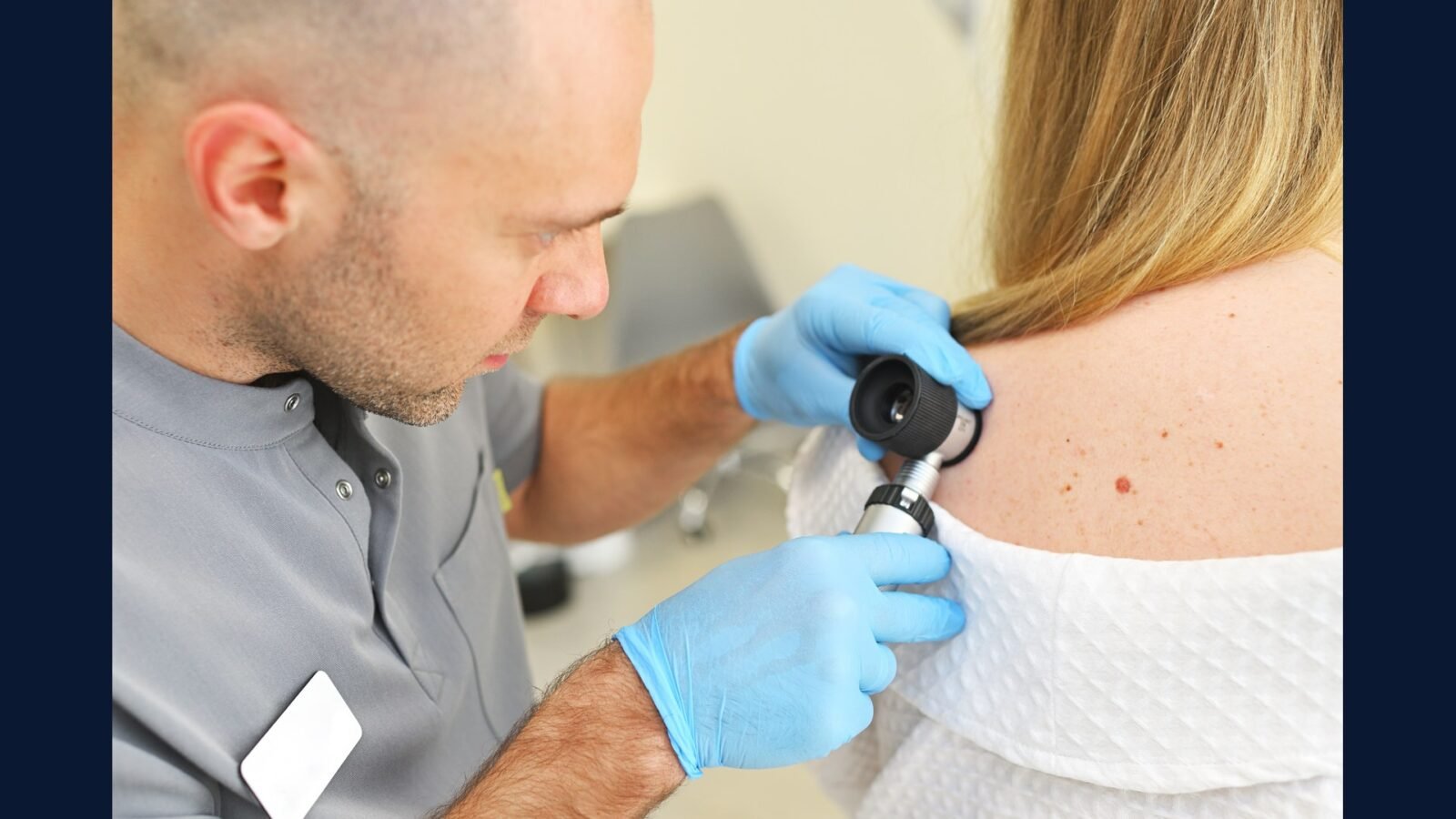 RSS dermato oncológica: melanoma, CBC, CEC, Mohs