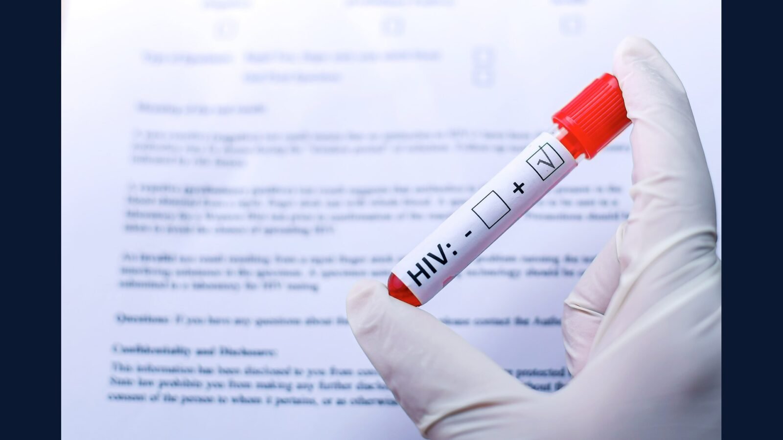 RSS infectologia: HIV, TB, hep B/C, HPV