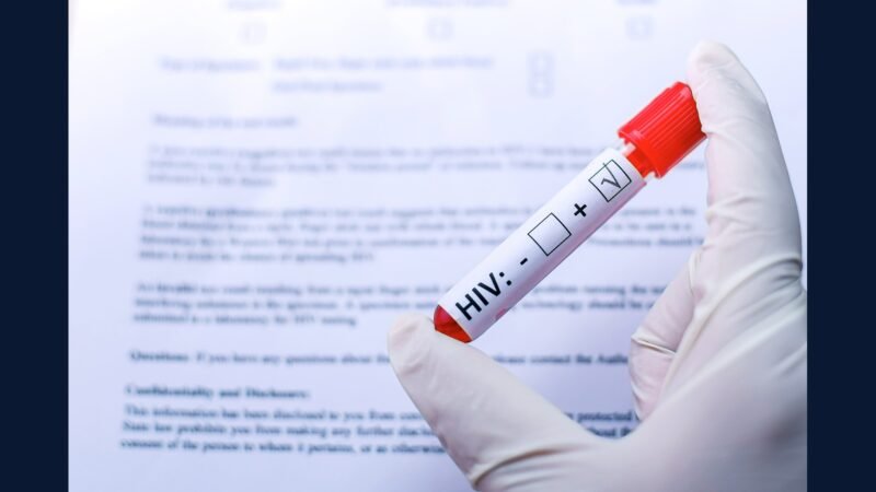 RSS infectologia: HIV, TB, hep B/C, HPV